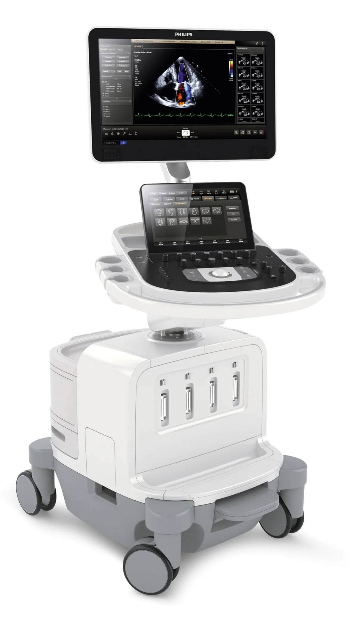 Philips EPIQ Elite Ultrasound