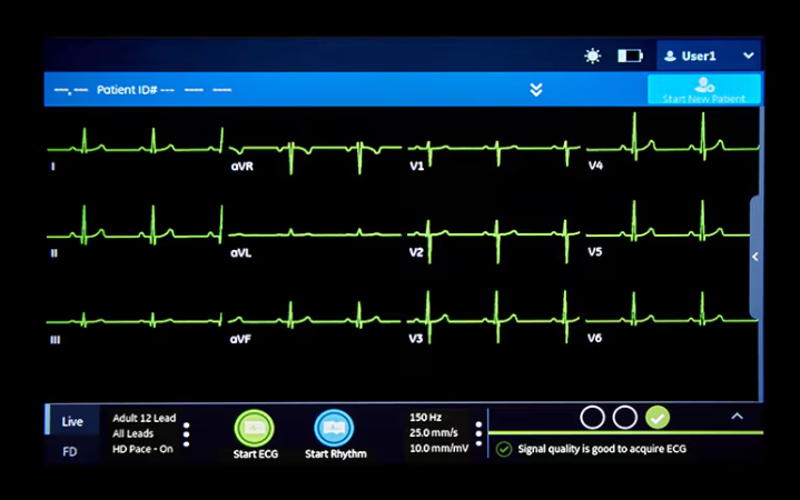 Electrocardiogram Image