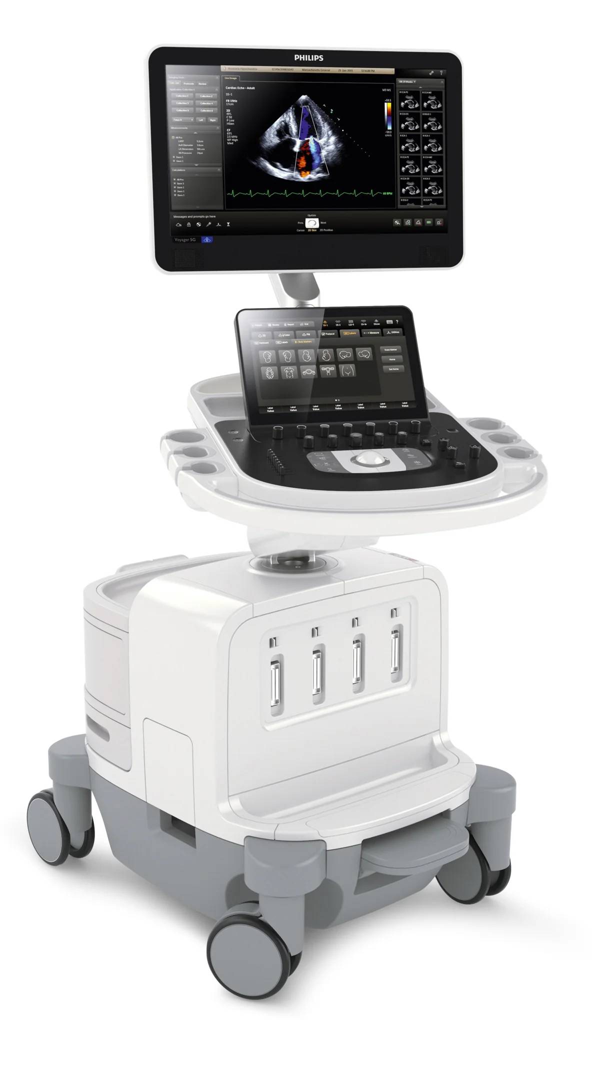 Transthoracic Echocardiogram